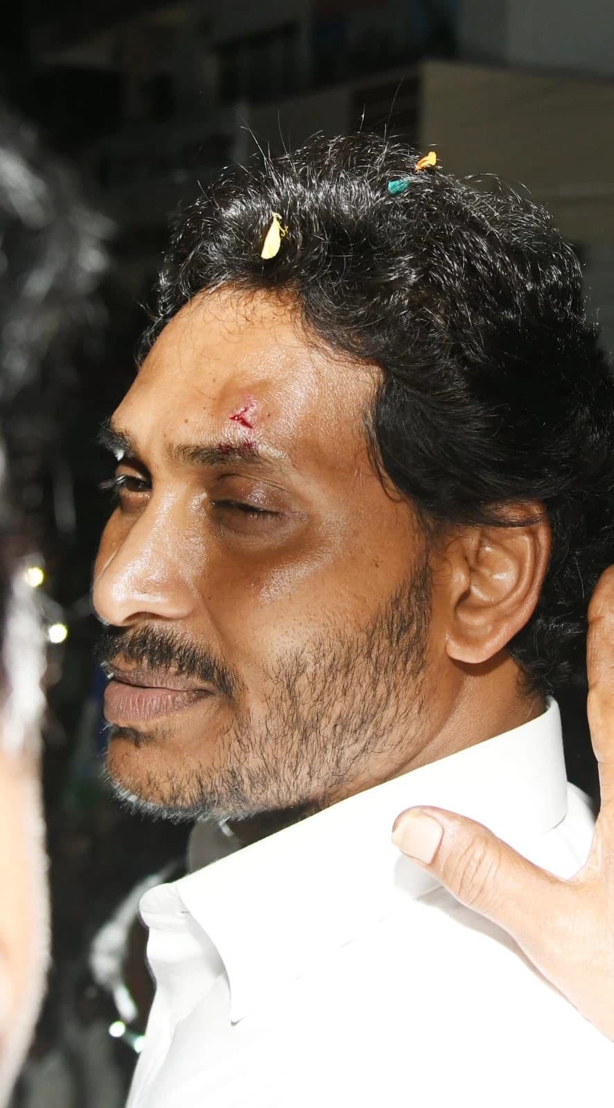 Andhra Pradesh CM Jagan Mohan Reddy Injured in Stone Pelting Incident during Vijayawada Roadshow