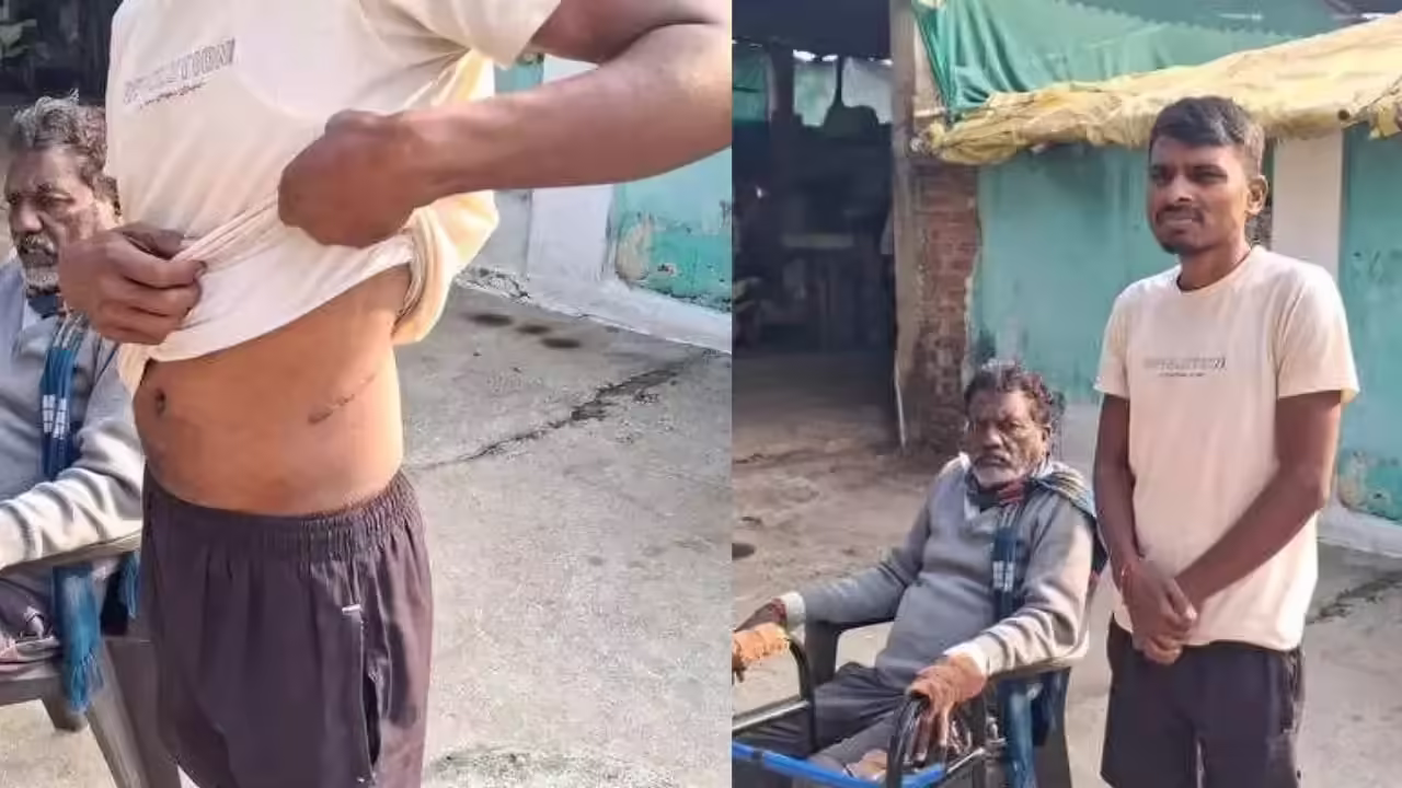 Debt Trap Turns Inhuman: Chandrapur Farmer Forced to Sell Kidney, Exposes Systemic Failure